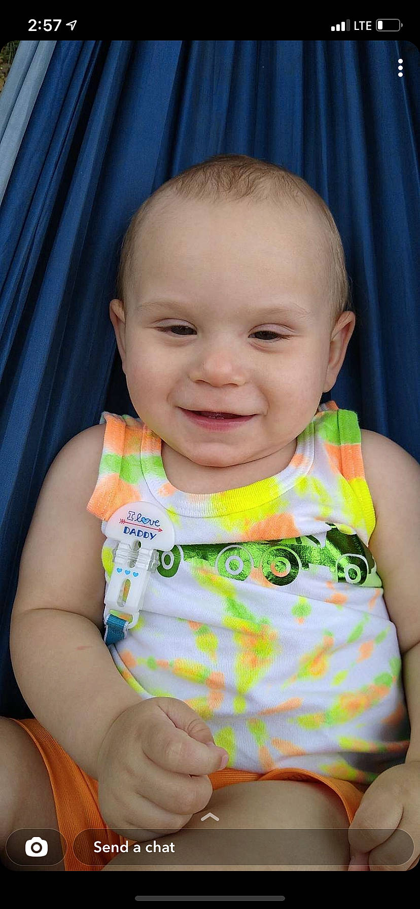 Konnor joined the competition — help win amazing prizes! arm, baby, baby_toddler_clothing, blue, cheek, chin, clothing, dress, eye, facial_expression, finger, human_body, iris, joy, lip, neck, nose, person, pink, skin