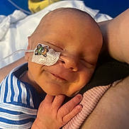 Freddie is registered to the contest to win money with this photo: newborn, baby, sleeping, smile, striped_clothing, hand, face, medical_tube, patch, skin, arm, comfort, closeup, infant, rest, cute, hospital, person, peaceful, holding