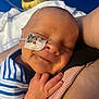 newborn, baby, sleeping, smile, striped_clothing, hand, face, medical_tube, patch, skin, arm, comfort, closeup, infant, rest, cute, hospital, person, peaceful, holding