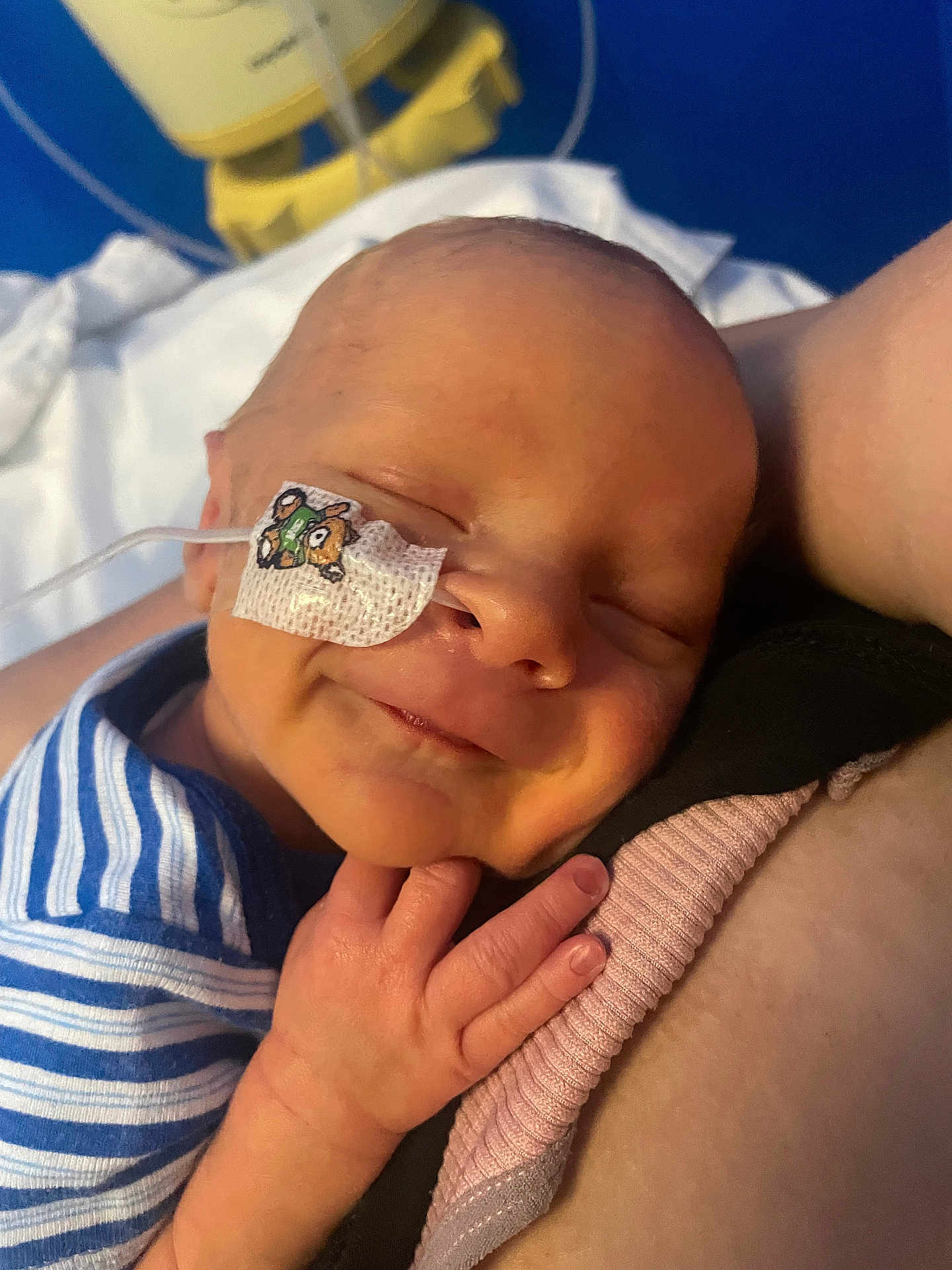 Freddie is registered to the contest to win money with this photo: newborn, baby, sleeping, smile, striped_clothing, hand, face, medical_tube, patch, skin, arm, comfort, closeup, infant, rest, cute, hospital, person, peaceful, holding