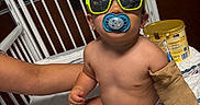 Ronan joined the competition — help win amazing prizes! baby, infant, pacifier, sunglasses, hospital_bed, bandage, iv_line, toy, bottle, socks, child, person, medical, healthcare, diaper, arm_wrap, play, cute, indoor, portrait