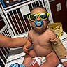 baby, infant, pacifier, sunglasses, hospital_bed, bandage, iv_line, toy, bottle, socks, child, person, medical, healthcare, diaper, arm_wrap, play, cute, indoor, portrait