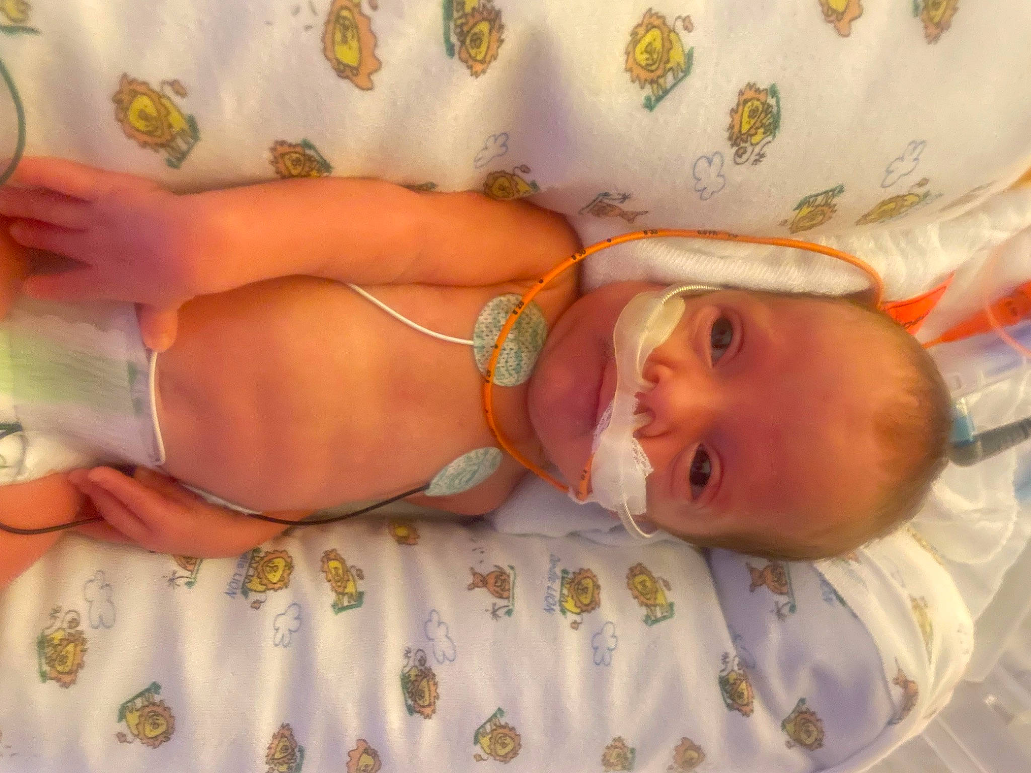 Emma joined the competition — help win amazing prizes! abdomen, baby, baby_products, baby_toddler_clothing, chest, child, comfort, diaper, head, human_body, human_leg, linens, pattern, person, skin, stomach, textile, thigh, toddler, trunk