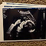 Brandon joined the competition — help win amazing prizes! ultrasound, fetus, medical_image, black_and_white, grayscale, printed_photo, carpet, baby, profile, womb, pregnancy, scan, healthcare, woman, monitor, diagnostic, sonogram, medical_equipment, blur, document
