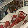 Kalani joined the competition — help win amazing prizes! newborn, infant, baby, sleeping, hospital, incubator, neonatal_care, premature_baby, medical_equipment, monitoring, blanket, hood, pacifier, medical_tubes, iv_line, hospital_bed, tiny_hands, tiny_feet, portrait, indoor