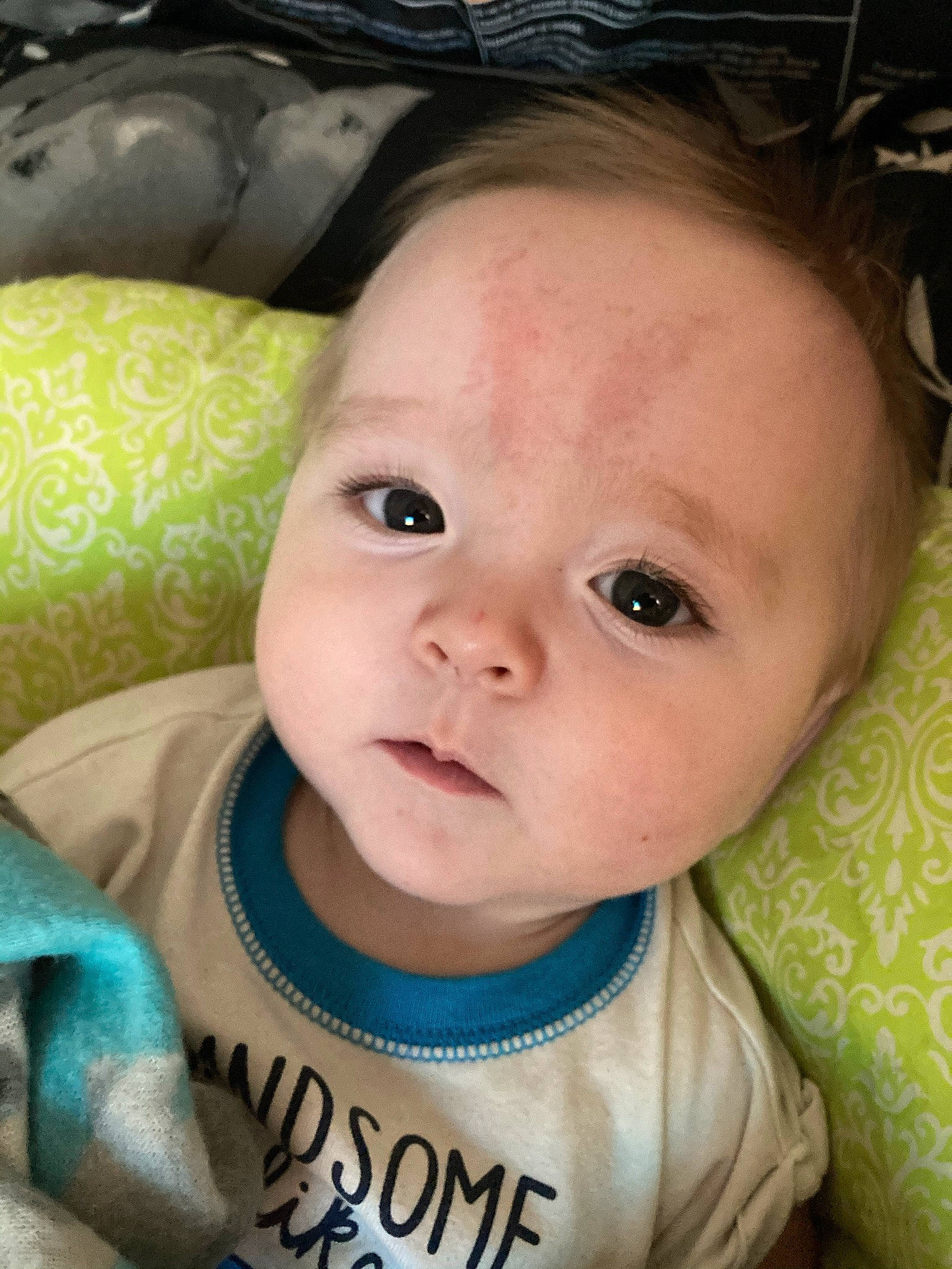Cj is registered to the contest to win money with this photo: baby, baby_products, baby_safety, baby_toddler_clothing, cheek, child, chin, close_up, comfort, ear, eye, eyebrow, eyelash, hairstyle, happy, iris, nose, person, skin, sleeve