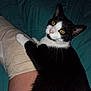 Larry is registered to the contest to win money with this photo: cat, black_and_white, yellow_eyes, paw, bandage, human_leg, blanket, indoor, pet, resting, fur, whiskers, curious, close_up, animal, cozy, comfort, domestic, companion, bedroom