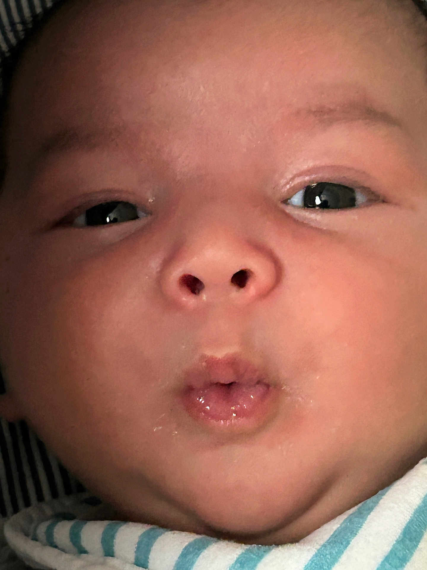 Sinan Ali joined the competition — help win amazing prizes! baby, face, closeup, expression, puckered_lips, skin, eyes, infant, cute, child, portrait, striped_blanket, mouth, nose, head, young, adorable, chubby_cheeks, human, person