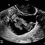 Mocha is registered to the contest to win money with this photo: ultrasound, medical_image, black_and_white, puppy, dog, hand, animal, scan, funny_edit, womb, pregnancy, grayscale, humor, pet, small_dog, cute, digital_art, composite, imaging, scan_measurement