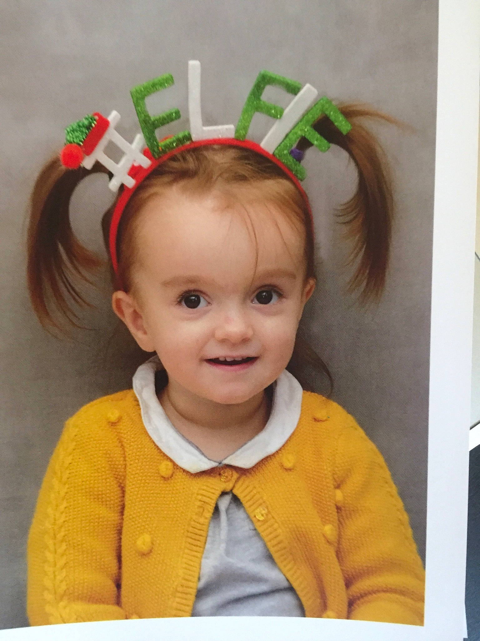 Aleïda participe au concours pour gagner de l'argent avec cette photo : baby, brown_hair, child, child_model, ear, face, fashion_accessory, forehead, hair, hair_accessory, head, headband, joy, organ, person, smile, toddler