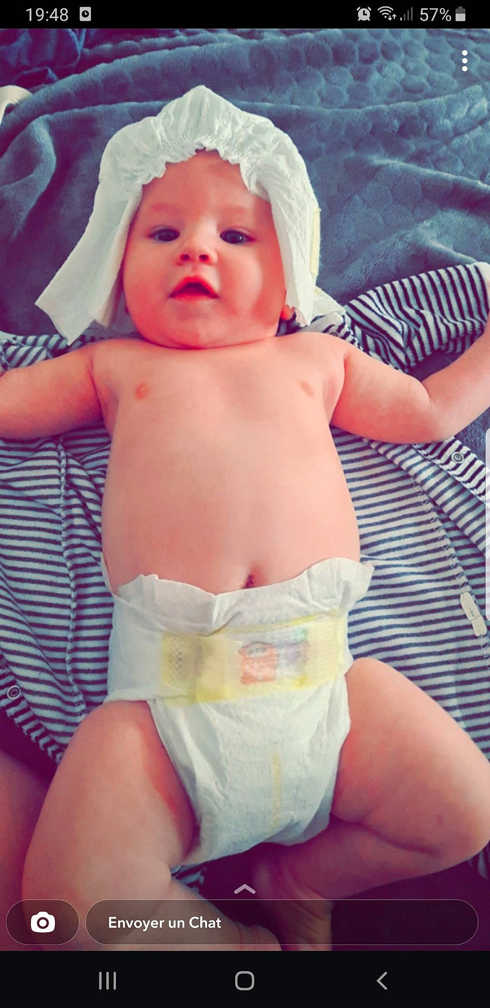 Mayron participe au concours pour gagner de l'argent avec cette photo : baby, baby_toddler_clothing, cheek, diaper, eye, face, finger, happy, headwear, leg, lip, mouth, muscle, organ, person, pink, shoulder, skin, stomach, thigh