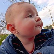 Rémi a rejoint le concours — aidez-le/la à gagner de superbes lots ! baby, infant, child, face, cheek, ear, nose, eyelashes, eyes, hoodie, zipper, clothing, outdoor, sky, grass, tree, portrait, close_up, rosy_cheeks, pout