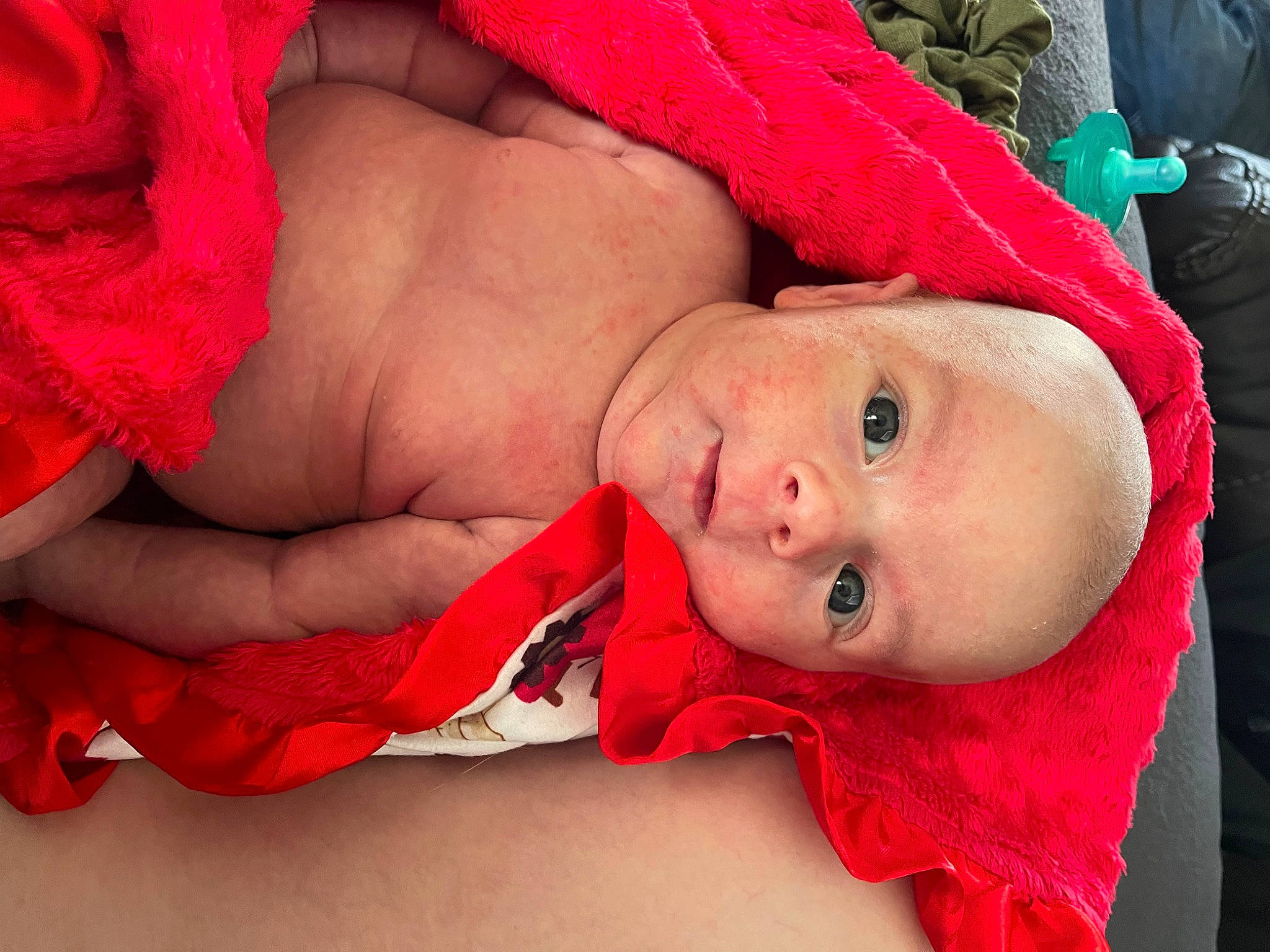 Zedric joined the competition — help win amazing prizes! abdomen, baby, baby_toddler_clothing, chest, child, close_up, comfort, event, eye, fur, human_body, human_leg, lip, mouth, person, pink, red, skin, textile, toddler