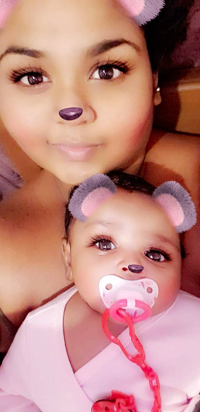 Lyïa participe au concours pour gagner de l'argent avec cette photo : baby, cheek, child, eyebrow, eyelash, face, head, lip, mouth, nose, person, skin, toddler