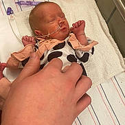 Madelyn is registered to the contest to win money with this photo: newborn, baby, hospital, medical_equipment, feeding_tube, hand, blanket, striped, clothing, infant, sleeping, person, cute, healthcare, bed, care, resting, tiny, hospital_bed, skin