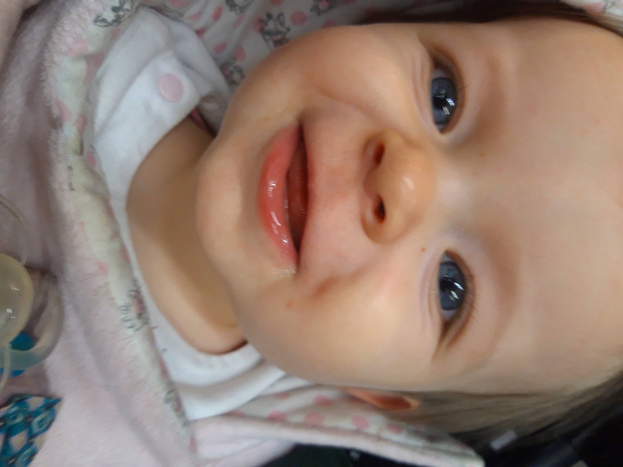 Molly a rejoint le concours — aidez-le/la à gagner de superbes lots ! baby, baby_toddler_clothing, cheek, child, chin, close_up, eye, eyebrow, eyelash, forehead, happy, iris, joy, lip, mouth, neck, nose, person, plant, skin