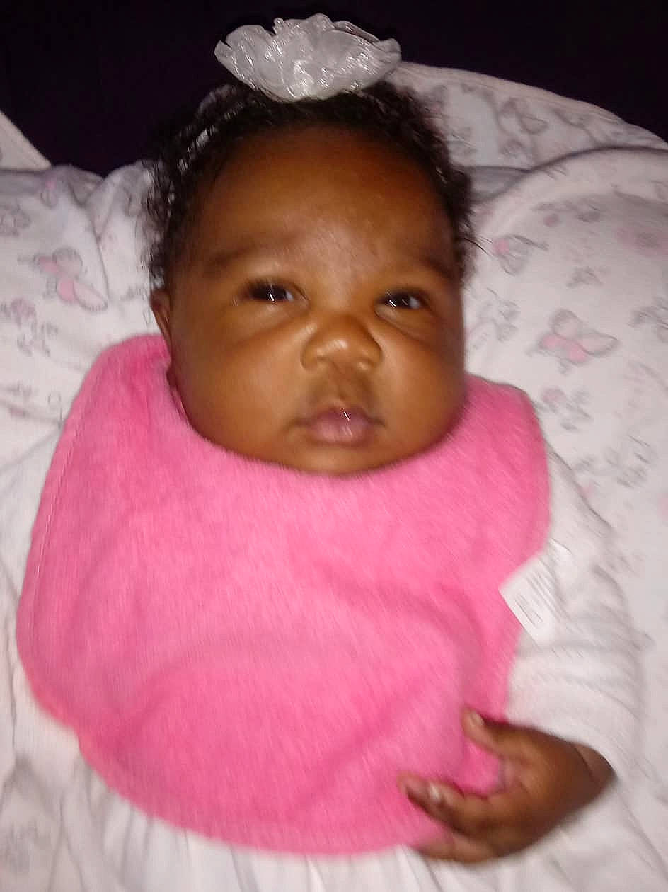 Egypt is registered to the contest to win money with this photo: cheek, child, face, girl, hair_accessory, head, infant, iris, lip, nose, person, pink, product, skin, smile, toddler