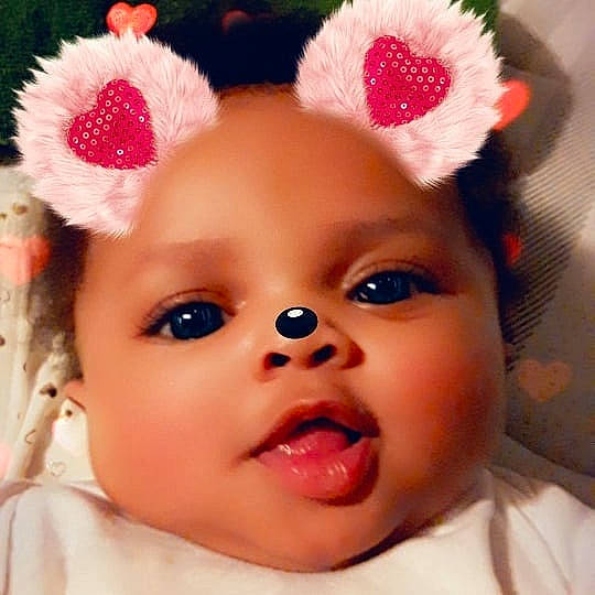 Janae is registered to the contest to win money with this photo: baby, baby_making_funny_faces, cheek, child, chin, close_up, ear, eye, eyebrow, face, facial_expression, forehead, hair_accessory, head, lip, mouth, nose, person, pink, skin