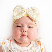 Yeshua is registered to the contest to win money with this photo: baby, infant, portrait, headband, bow, chubby_cheeks, close_up, white_background, onesie, cute, soft_skin, studio_light, neutral_expression, face, eyes, adorable, baby_clothing, fruit_print, round_face, sleepy_look