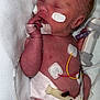 Ayla Jane is registered to the contest to win money with this photo: baby, blanket, child, cute, diaper, electrodes, face, foot, hand, healthcare, hospital, infant, medical, monitoring, newborn, patient, resting, skin, sleeping, tube