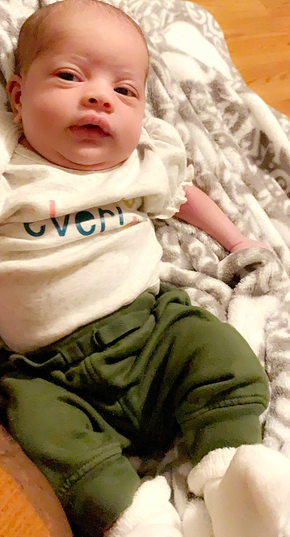 Mkylee is registered to the contest to win money with this photo: baby, baby_toddler_clothing, cheek, child, person, skin, toddler