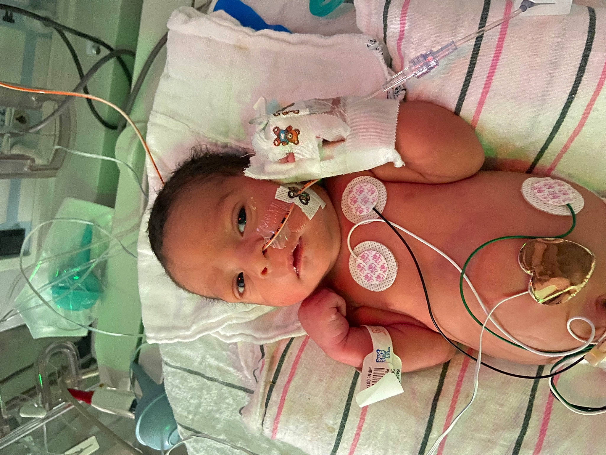 Keziah is registered to the contest to win money with this photo: abdomen, baby, baby_products, baby_toddler_clothing, chest, child, comfort, eyelash, fashion_accessory, flesh, foot, jewellery, mouth, nail, peach, person, room, service, skin, toddler