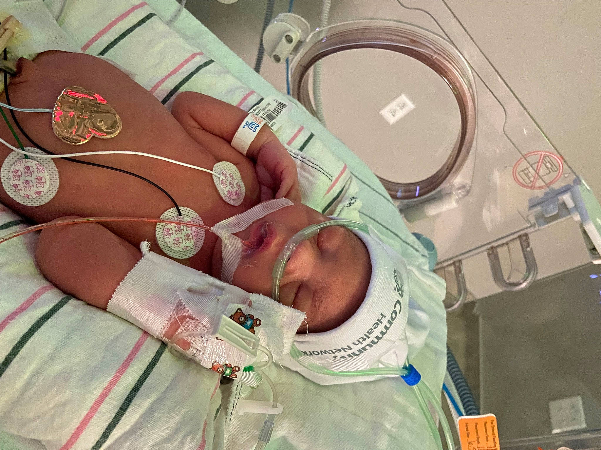 Keziah joined the competition — help win amazing prizes! audio_equipment, automotive_design, baby, circle, comfort, drinkware, event, eyelash, eyewear, fashion_accessory, health_care, hospital, jewellery, linens, medical, medical_equipment, medical_procedure, peach, person, room