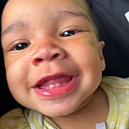 Aurora joined the competition — help win amazing prizes! apparel, baby, background, bow, child, closeup, cute, eyes, fabric, face, happy, head, infant, mouth, person, portrait, skin, smiling, teeth, yellow_clothing