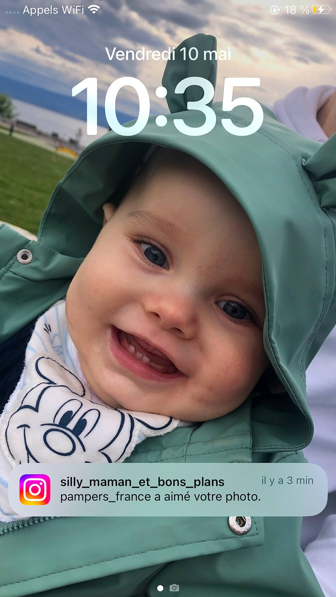 Enea participe au concours pour gagner de l'argent avec cette photo : baby, baby_laughing, cheek, child, chin, cool, eyebrow, facial_expression, fashion_accessory, font, forehead, happy, headwear, joy, lip, mouth, nose, organ, person, photo_caption