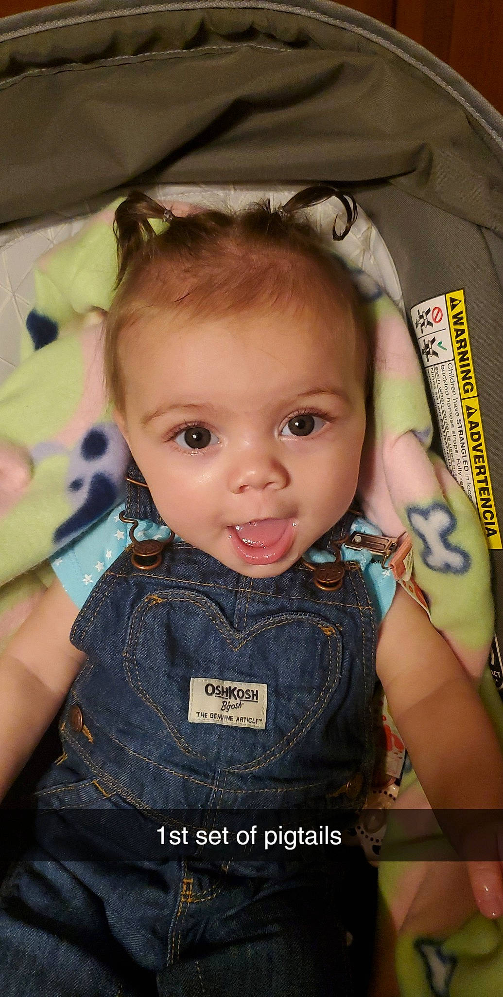 Winry joined the competition — help win amazing prizes! arm, baby, baby_toddler_clothing, cheek, chin, ear, eye, eyebrow, eyelash, face, facial_expression, flash_photography, hairstyle, head, iris, lip, mouth, nose, person, skin