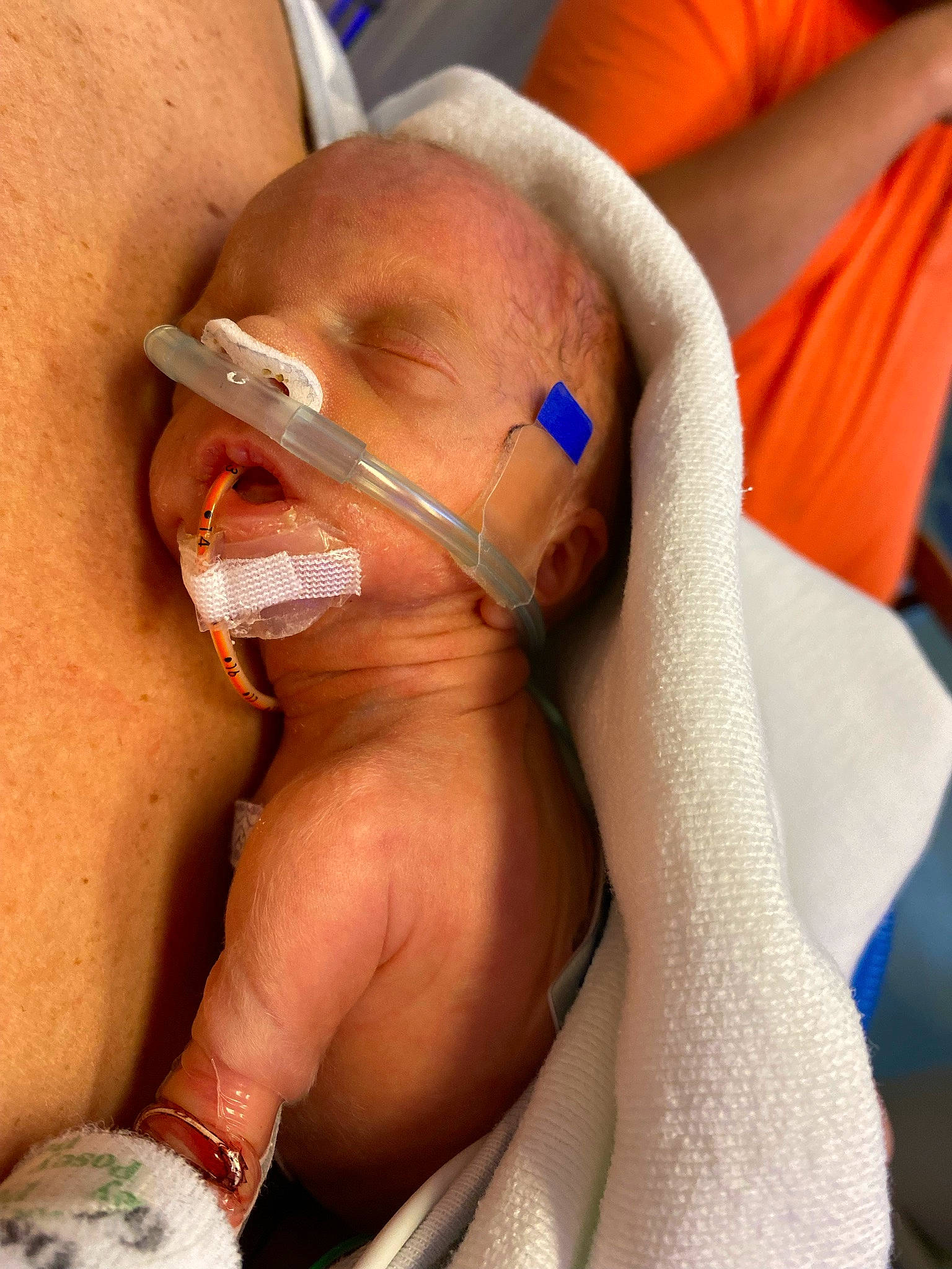 Hasley is registered to the contest to win money with this photo: arm, chest, comfort, eyelash, finger, gesture, human_body, jaw, knee, leg, medical, mouth, neck, nose, patient, person, skin, thumb, tooth, trunk