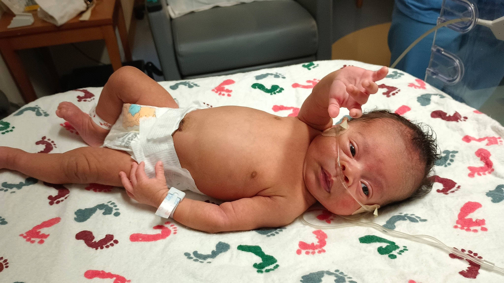 Kiana joined the competition — help win amazing prizes! abdomen, baby, baby_toddler_clothing, cheek, chest, child, comfort, diaper, event, eye, finger, flesh, foot, human_leg, navel, person, skin, stomach, thigh, toddler