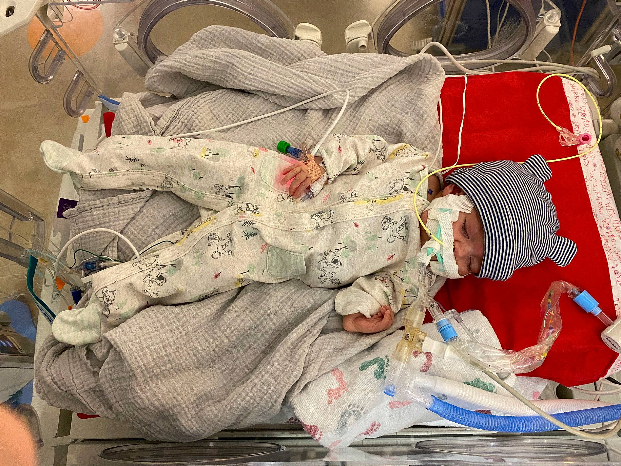 Cristian joined the competition — help win amazing prizes! astronaut, baby_products, baby_toddler_clothing, bed, bed_sheet, bedding, carmine, comfort, headwear, health_care, hospital_bed, linens, medical_equipment, medical_procedure, nap, patient, pattern, person, room, service