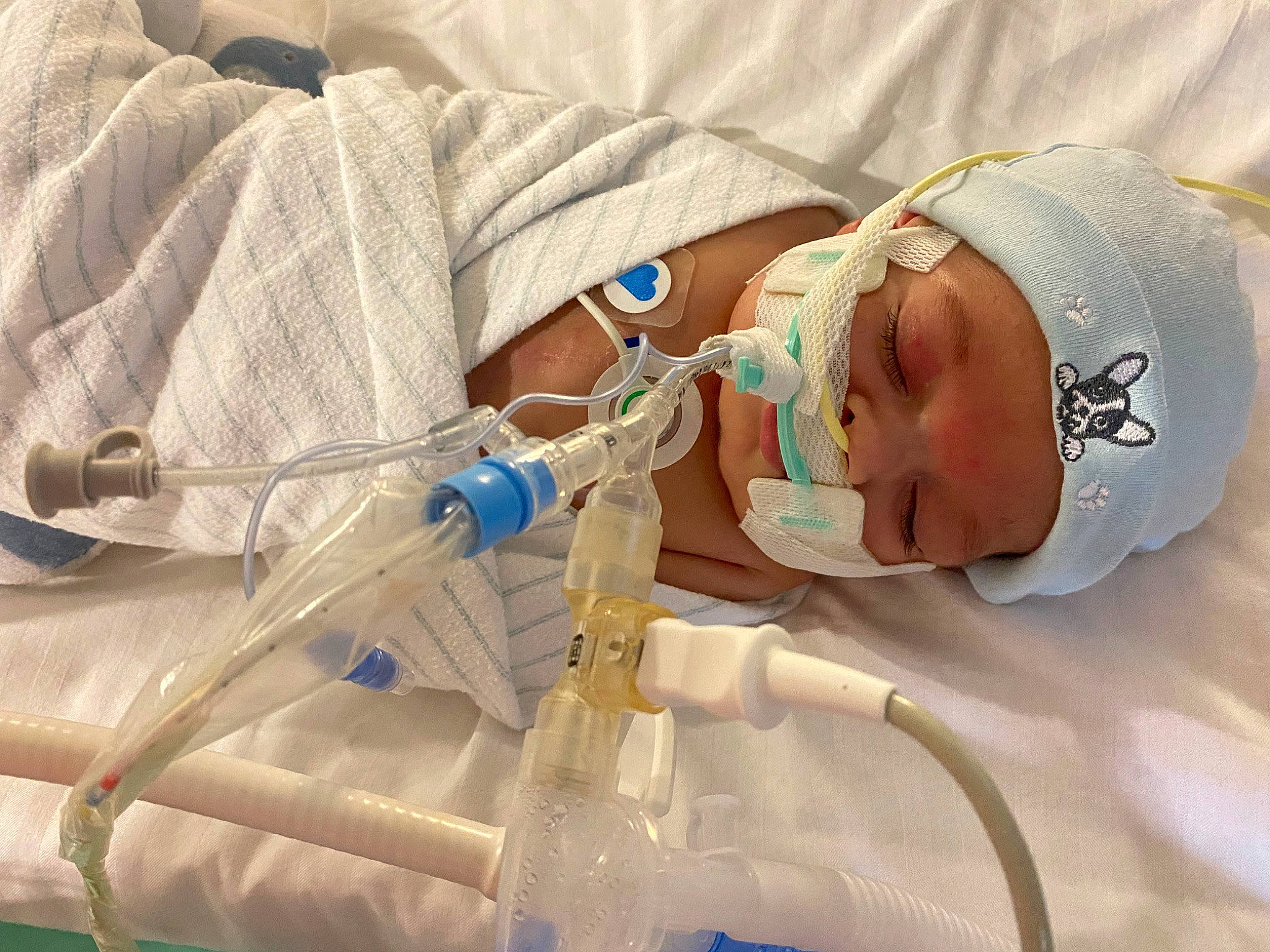 Cristian joined the competition — help win amazing prizes! baby, child, comfort, eye, eyelash, hat, health_care, hospital, human_body, medical, medical_equipment, medical_procedure, patient, person, plastic, plastic_bottle, science, service, skin, toddler