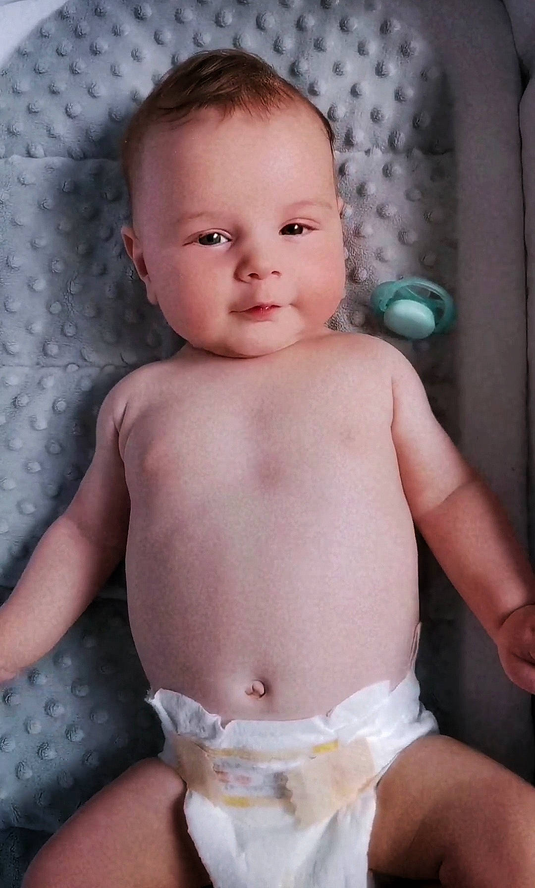 Abel participe au concours pour gagner de l'argent avec cette photo : baby, cheek, chest, eyelash, finger, head, human_body, iris, joint, lip, mouth, muscle, nose, organ, person, product, skin, stomach, thumb, trunk