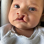 Hayden participe au concours pour gagner de l'argent avec cette photo : baby, infant, close_up, face, cleft_lip, eyes, knitted_sweater, white_clothing, cute, child, portrait, soft_light, indoors, cushion, button, newborn, skin, expression, young_child, seated