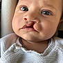 baby, infant, close_up, face, cleft_lip, eyes, knitted_sweater, white_clothing, cute, child, portrait, soft_light, indoors, cushion, button, newborn, skin, expression, young_child, seated