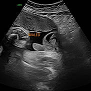 Nasr joined the competition — help win amazing prizes! ultrasound, fetus, medical_image, scan, black_and_white, womb, pregnancy, prenatal, healthcare, baby, sonogram, human_body, doctor, clinic, monitoring, gestation, obstetrics, medical_equipment, text_overlay, name