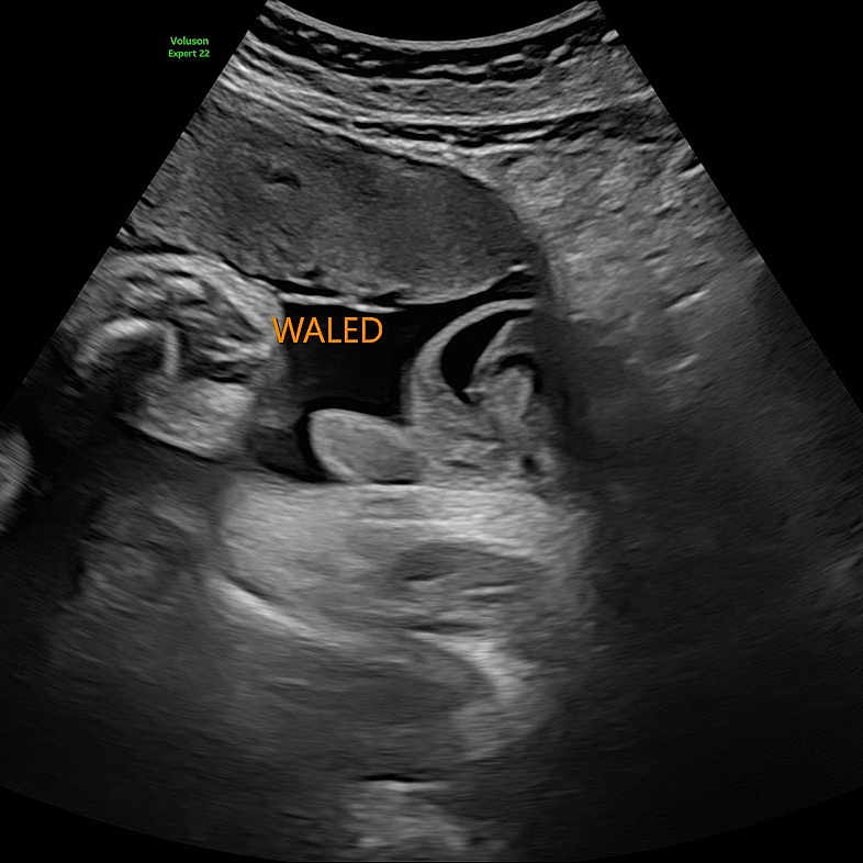 Nasr joined the competition — help win amazing prizes! ultrasound, fetus, medical_image, scan, black_and_white, womb, pregnancy, prenatal, healthcare, baby, sonogram, human_body, doctor, clinic, monitoring, gestation, obstetrics, medical_equipment, text_overlay, name