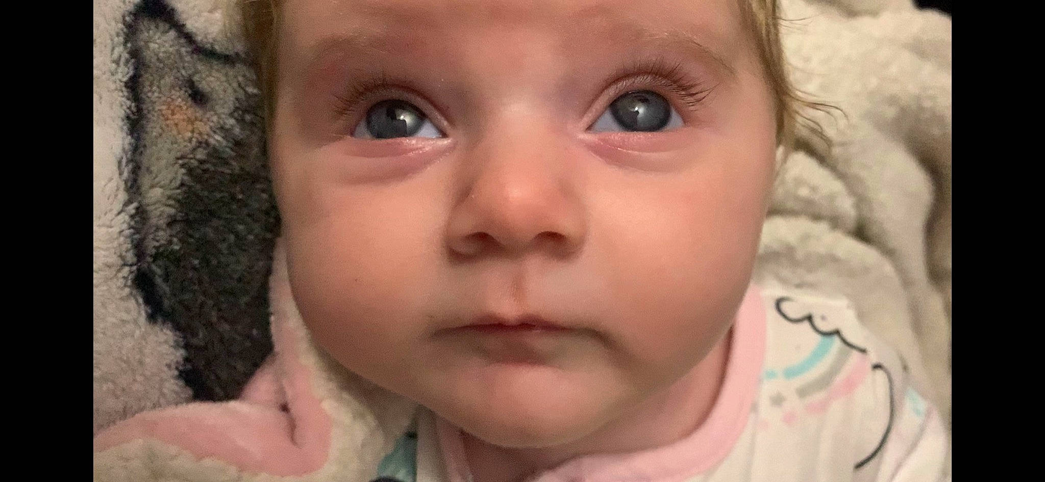 Collins is registered to the contest to win money with this photo: baby, beauty, cheek, child, chin, close_up, ear, eye, eyebrow, eyelash, face, facial_expression, forehead, head, iris, lip, mouth, nose, person, skin