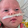 Novalee is registered to the contest to win money with this photo: baby, infant, face, nasal_tube, medical_tape, eyes, mouth, clothing, bed, hospital, patient, close_up, skin, head, newborn, person, healthcare, child, cute, portrait