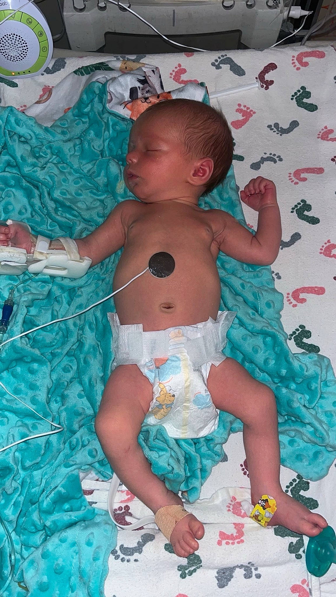 Cooper is registered to the contest to win money with this photo: abdomen, aqua, baby, baby_products, baby_toddler_clothing, chest, child, diaper, event, fun, happy, human_body, pattern, person, pink, product, stomach, textile, thigh, toddler