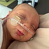 newborn, baby, sleeping, hospital, medical_tube, medical_patch, infant, face, skin, head, closeup, person, patient, healthcare, rest, peaceful, indoors, blanket, soft, care