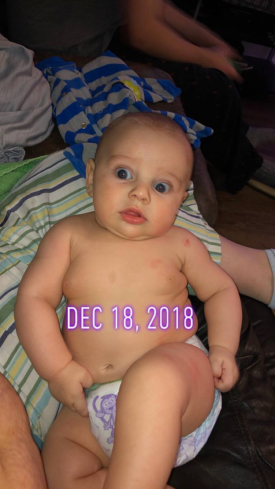 Dante joined the competition — help win amazing prizes! abdomen, cheek, child, diaper, finger, fun, girl, hand, head, infant, iris, lap, leg, mouth, person, product, sitting, skin, toddler, trunk