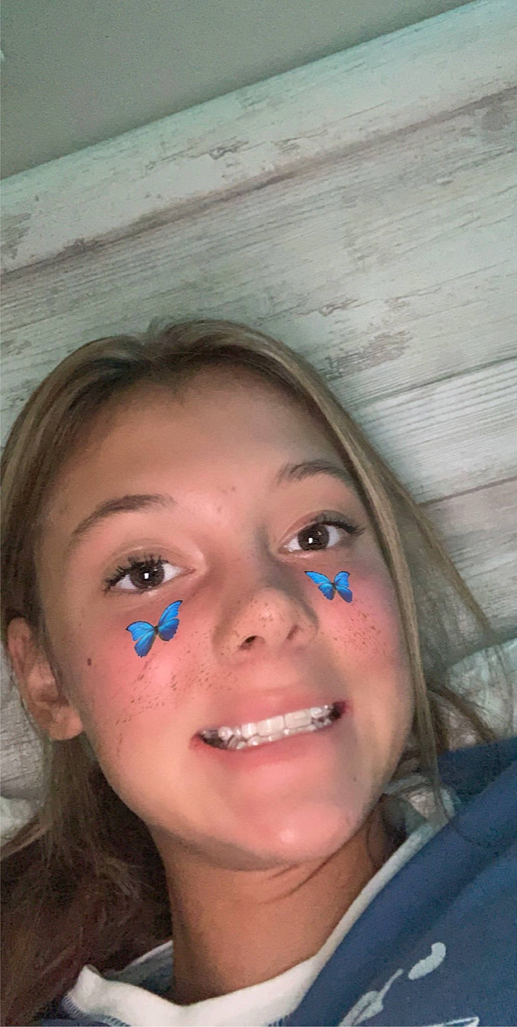 Kailyn joined the competition — help win amazing prizes! cheek, close_up, dental_braces, eyebrow, face, facial_expression, fun, head, jaw, joy, lip, mouth, nose, organ, person, skin, smile, tooth