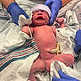 Colton is registered to the contest to win money with this photo: newborn, baby, crying, umbilical_cord, hospital, medical_gloves, blanket, infant, delivery, fresh, human, person, skin, hat, hands, care, birth, healthcare, child, medical