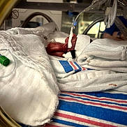 Alma joined the competition — help win amazing prizes! premature_baby, incubator, medical_tubes, blanket, hospital, neonatal_care, newborn, baby, wrapped, white_cloth, fragile, healthcare, tiny, patient, care, infant, bed, soft, monitoring, medical_equipment