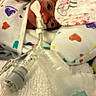 newborn, baby, incubator, hospital, medical_tubes, blanket, heart_pattern, face, head, medical_care, infant, wrapped, lying_down, premature_baby, healthcare, closeup, soft_cloth, breathing_tube, person, child