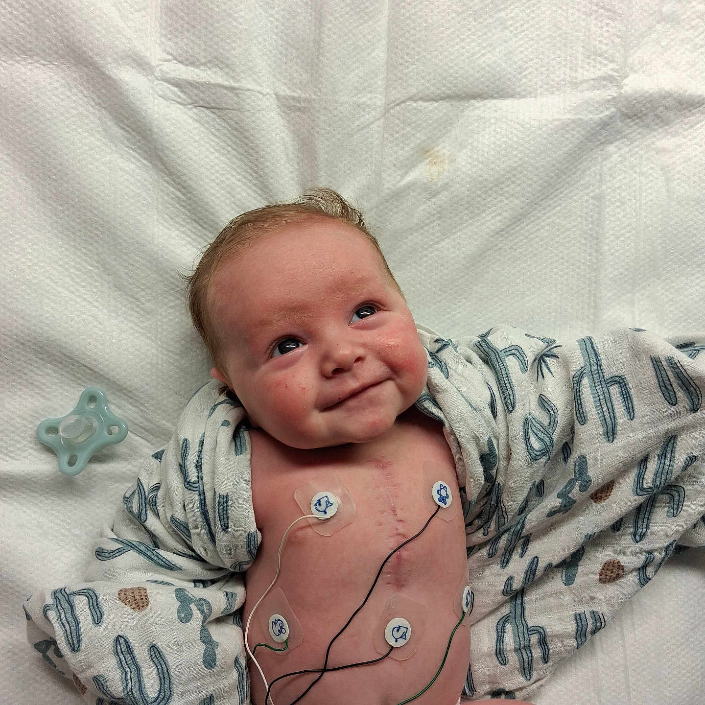 Waylon joined the competition — help win amazing prizes! baby, infant, smiling, medical, electrodes, blanket, cactus_pattern, diaper, hospital, cute, skin, face, lying_down, healthcare, monitoring, newborn, child, expression, indoors, resting
