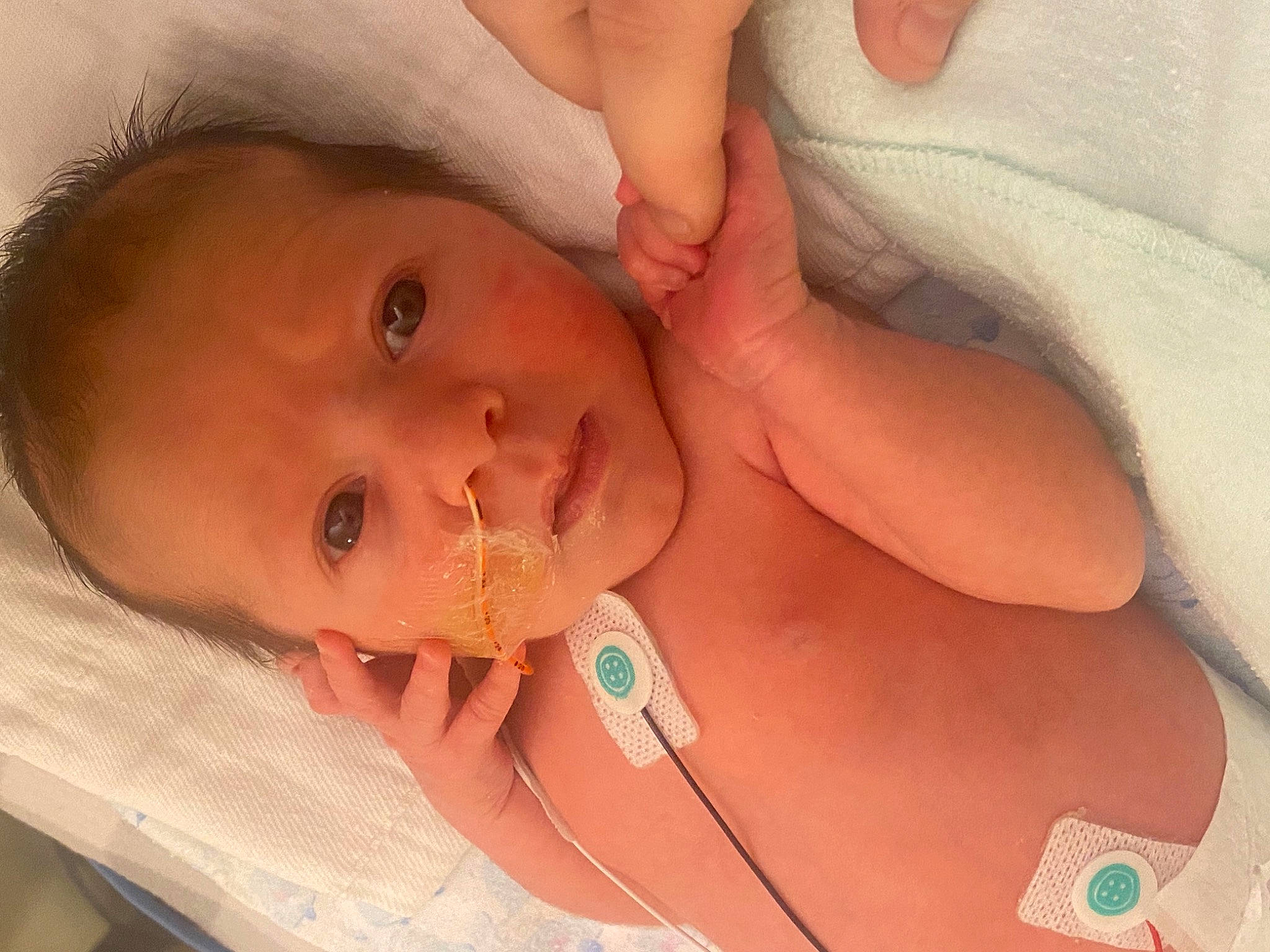 Emmalyn is registered to the contest to win money with this photo: arm, baby, cheek, chin, ear, eye, eyebrow, eyelash, face, finger, forehead, head, human_body, iris, lip, mouth, neck, nose, person, skin